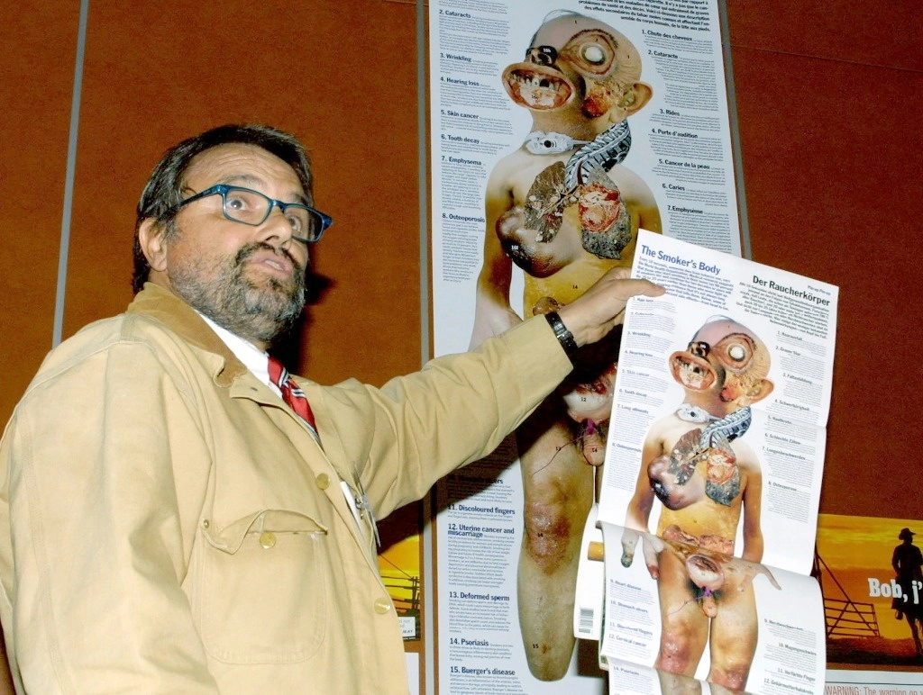 El fotógrafo italiano Oliviero Toscani sostiene un cartel que muestra el "Cuerpo de un Fumador" durante una conferencia de prensa sobre publicidad del tabaco, en Ginebra, Suiza, el 21 de marzo de 2002. Foto Ap