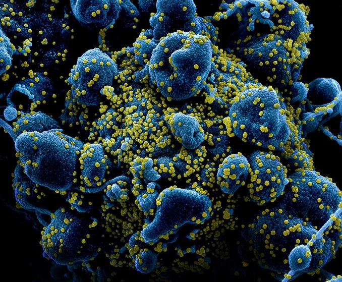 Los genes que juegan un papel importante en permitir que el SARS-CoV-2 invada las células del corazón se vuelven más activos con la edad, según una investigación publicada en la revista Journal of Molecular and Cellular Cardiology. Imagen tomada de https://www.gaceta.unam.mx/asi-ataca-el-coronavirus-covid-19-una-celula-humana/