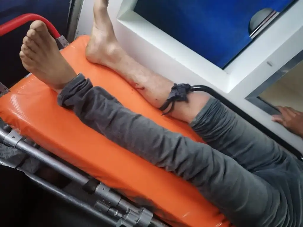 Julio César Pérez Pérez resultó herido durante un ataque armado de habitantes de la comunidad de Santa Martha, en contra de su vecina Aldama en el municipio de Chenalhó, el 23 de mayo de 2021. Foto La Jornada 