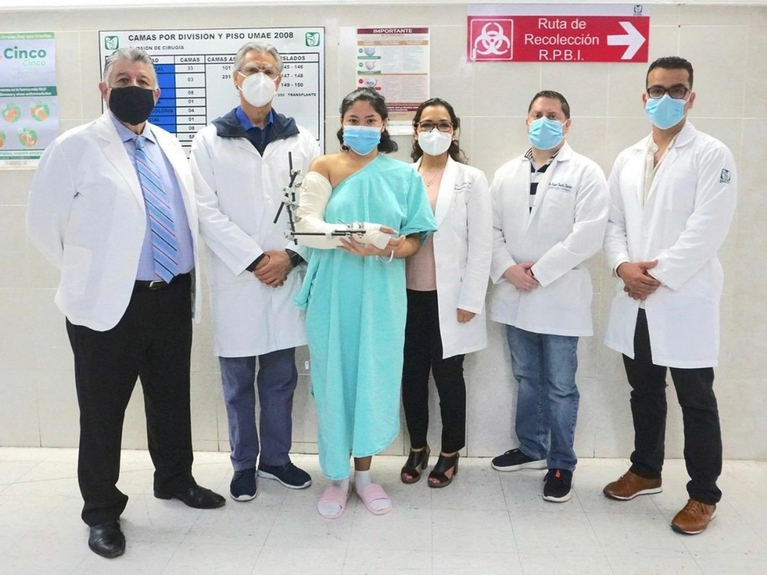 El IMSS informó que especialistas en Traumatología y Ortopedia, Cirugía Reconstructiva y Angiología de la Unidad Médica de Alta Especialidad número 1 en León, Guanajuato, realizaron un reimplante total de brazo a la paciente Melissa, quien sufrió un accidente laboral con una máquina que le arrancó la extremidad. Foto tomada del Twitter de @zoerobledo