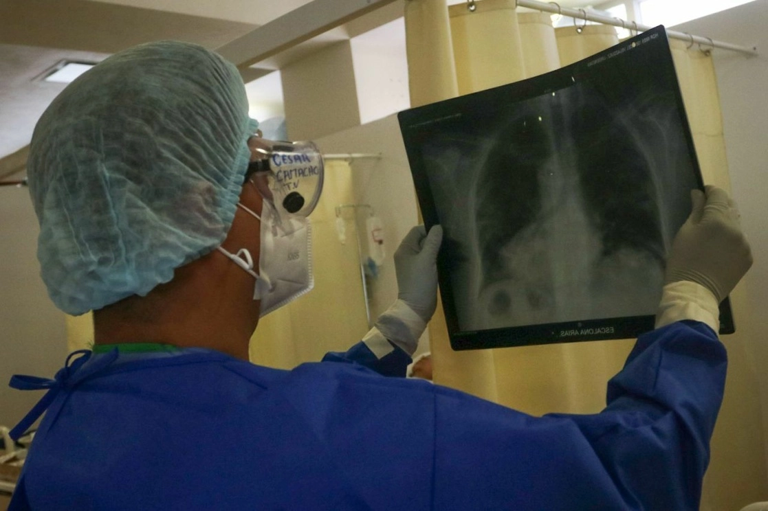 Médicos especializados de diversas disciplinas han insistido: no realizar una adecuada rehabilitación en la etapa “post-contagio” puede convertir a numerosas personas en “incapaces respiratorias” lo que, de convertirse en un problema extendido, eventualmente dejaría una fuerza laboral mermada en el país, entre otras consecuencias. Foto Cuartoscuro / Archivo