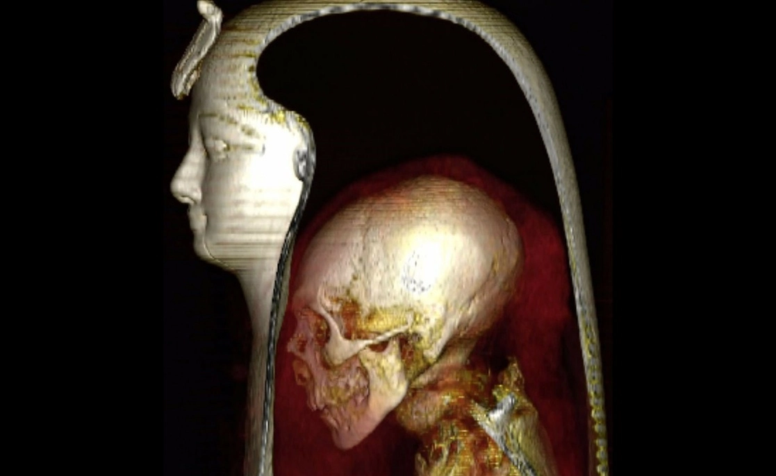 La imagen tridimensional de la cabeza de la momia envuelta de Amenhotep I en una vista lateral izquierda permite la visualización de las capas componentes: la máscara, la cabeza y los vendajes circundantes. Foto Europa Press