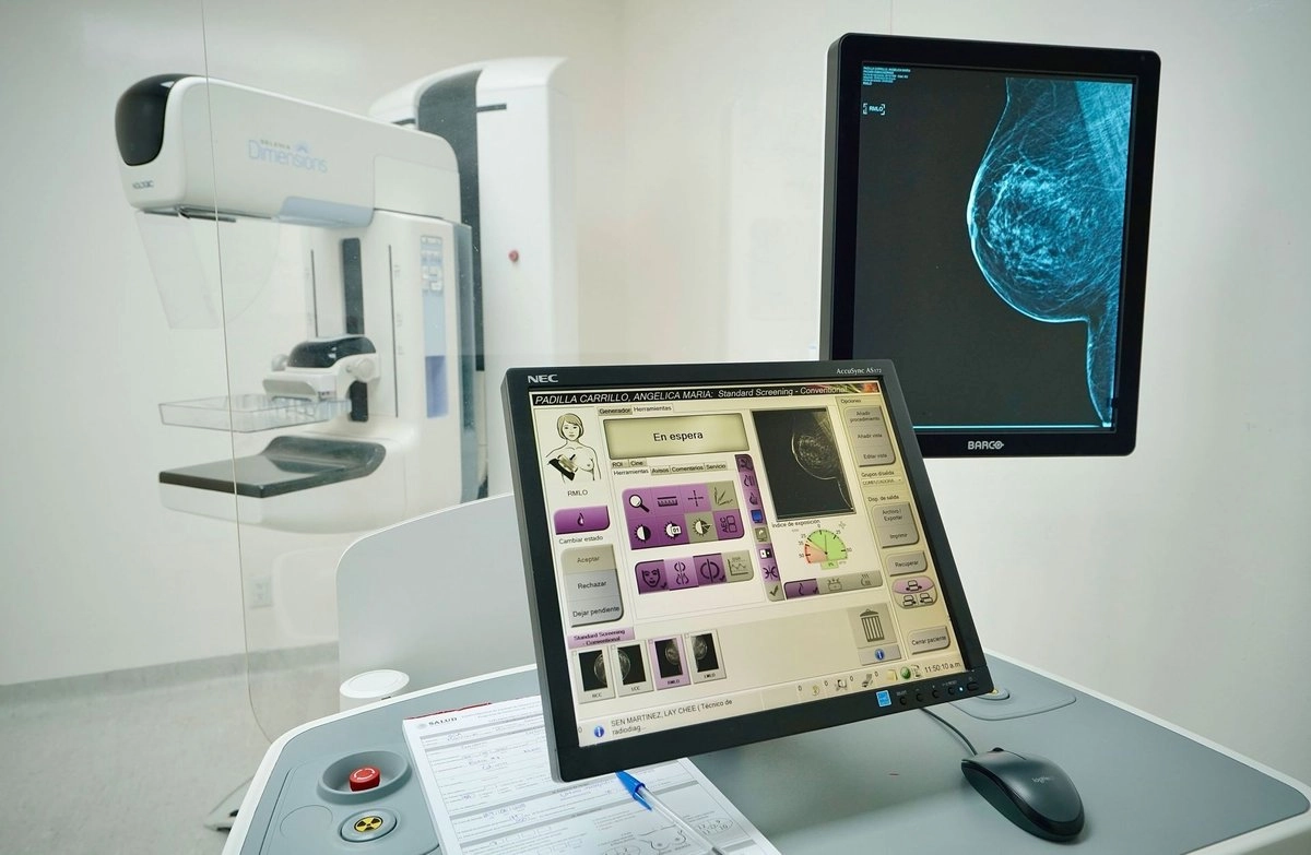 Lanzan modelo integral de atención de cáncer de mama con inversión de 8 mil mdp. Foto 

