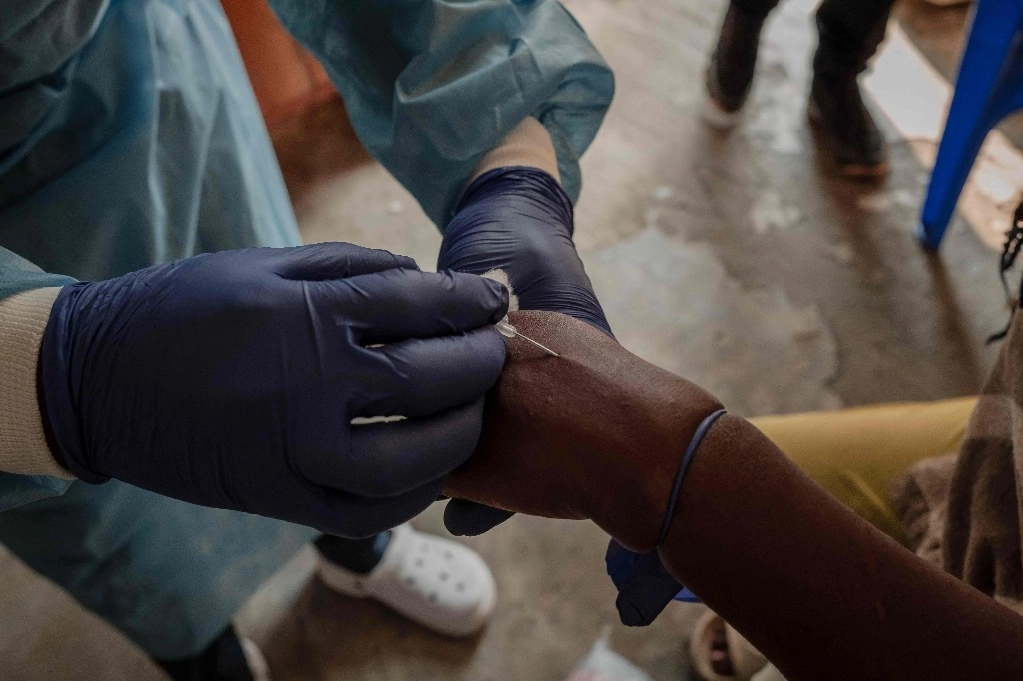 'Toma' de muestra de sangre en el centro de tratamiento de mpox en el hospital de Nyiragongo, en República Democrática del Congo. Foto Afp  

