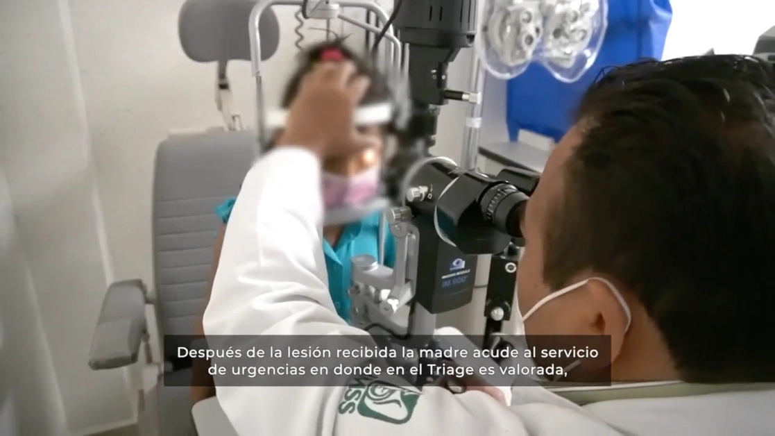 Médicos del Hospital General de Zona número 1 “Nueva Frontera” del IMSS, en Tapachula, Chiapas, consiguieron con éxito que una menor de ocho años recuperara la visión, luego de que sufriera un corte de espesor total de la córnea. Captura de imagen de video subido en el Twitter @Tu_IMSS