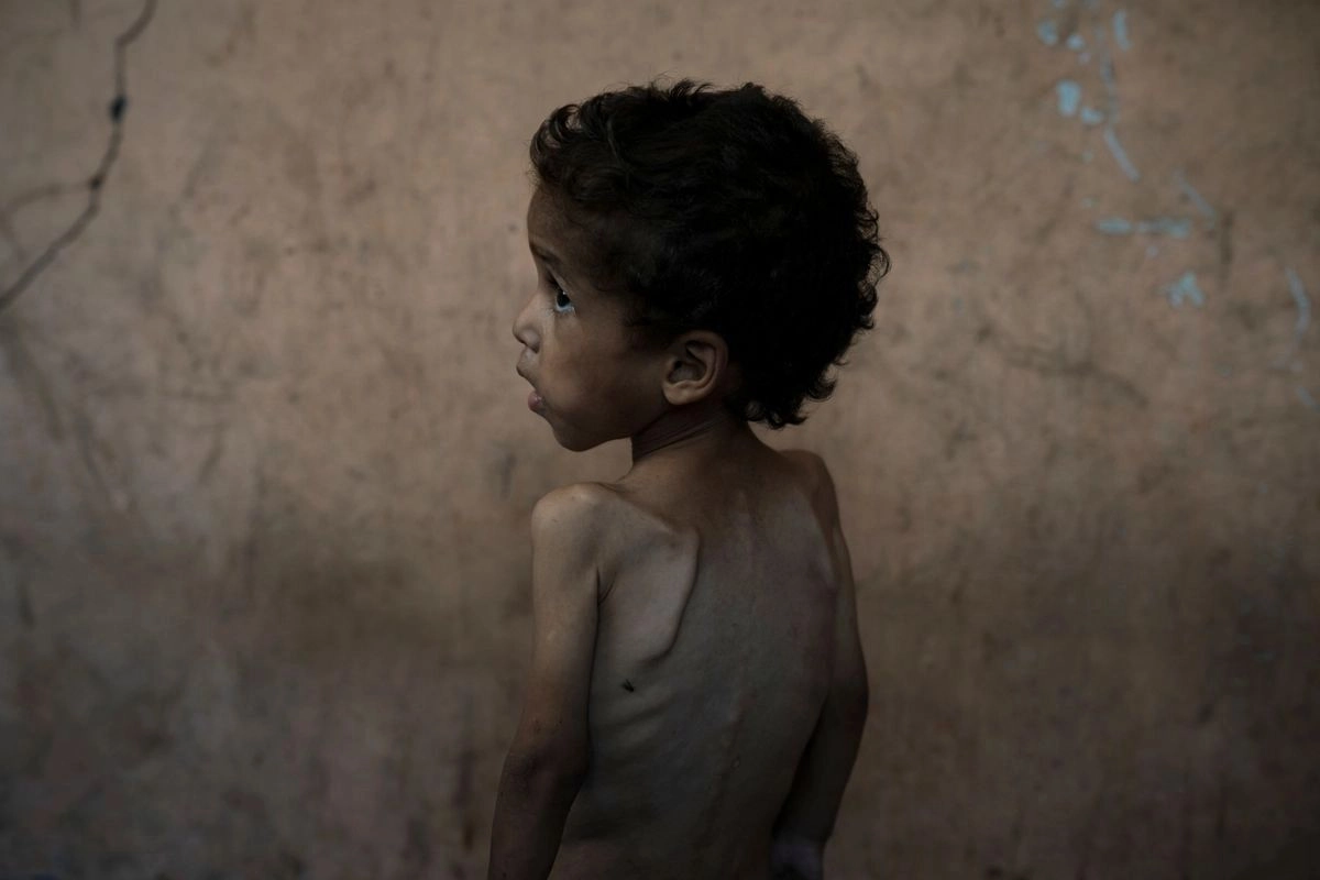Con el genocidio por hambre, intencionado, sistemático y bien organizado contra las niñas y niños gazatíes, el Estado de Israel ha pegado duro en todo el mundo, ha borrado fronteras y unificado ánimos. Foto