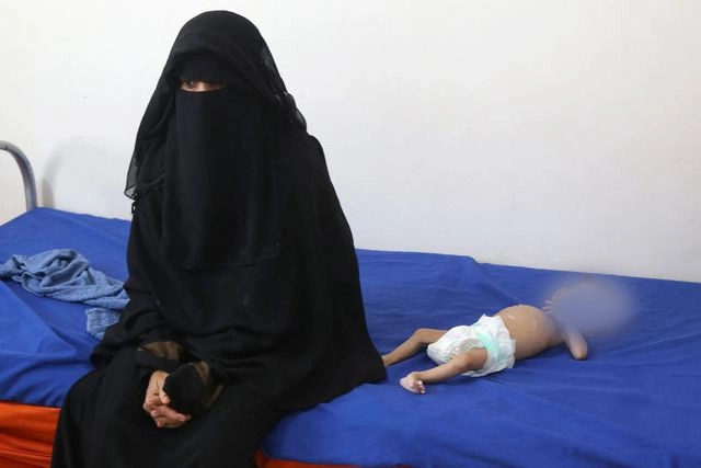 Millones de niños en Yemen se encuentran en grave riesgo de desnutrición, alertó la Unicef. Foto Afp