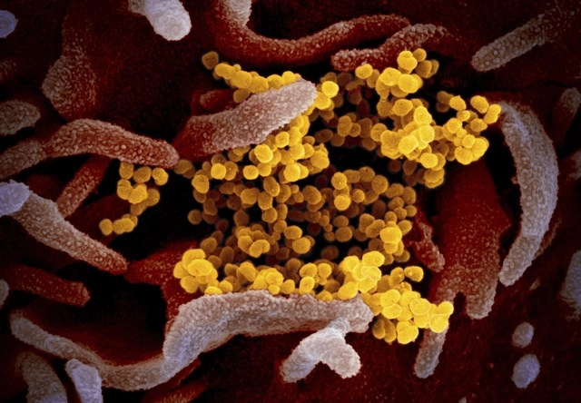 La OMS deploró el jueves que una "larga lista" de países no está haciendo lo suficiente para combatir el coronavirus. Foto Ap 