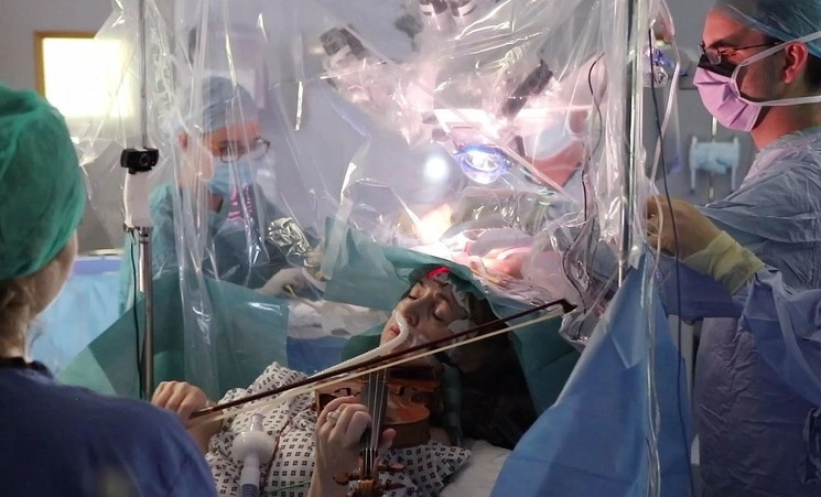 La violinista Dagmar Turner, de 53 años, es despertada en medio de una cirugía cerebral para que toque su instrumento. Foto Afp