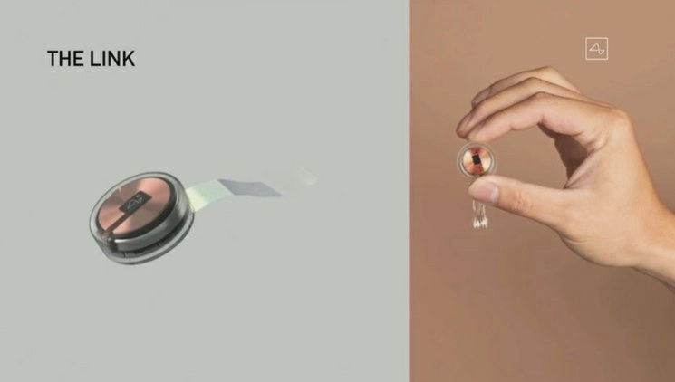 El dispositivo, que tiene forma de moneda y se instala en el cráneo, se conecta con microhilos al sistema nervioso y puede emparejarse con una aplicación para teléfonos móviles a través de Bluetooth. "Es como un Fitbit en tu cráneo con pequeños cables", ha indicado Musk. Imagen tomada de la transmisión por YouTube