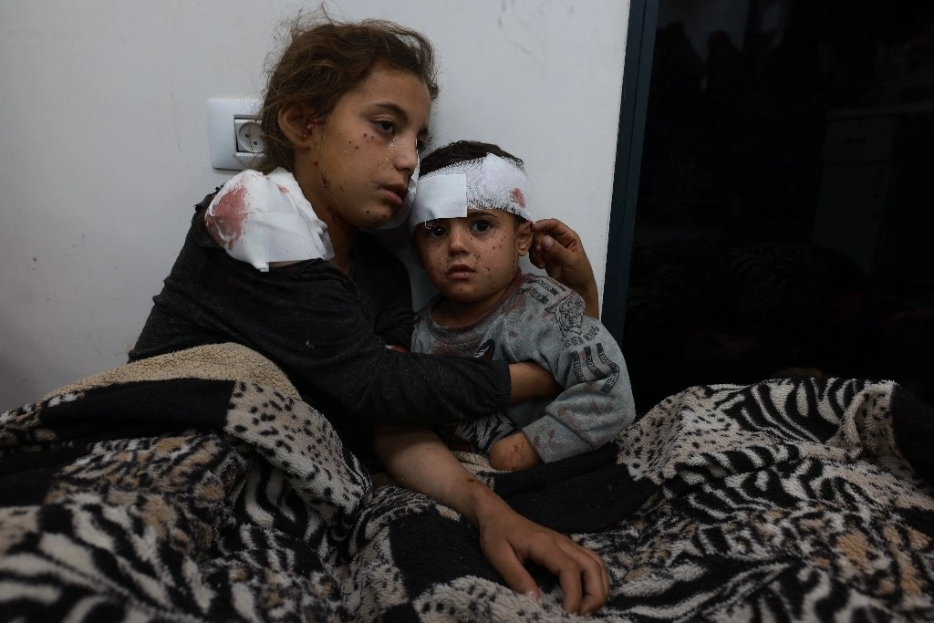 Una niña palestina y su hermano resultaron heridos hoy tras los bombardeos israelíes sobre Rafá, en el sur de Gaza. Foto Afp 