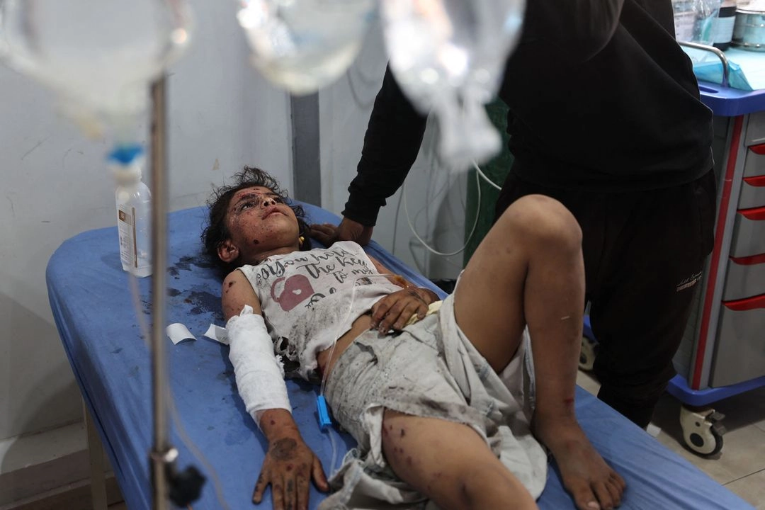 Atención a una niña palestina herida por los bombardeos de Israel ayer en el hospital de Nuseirat.