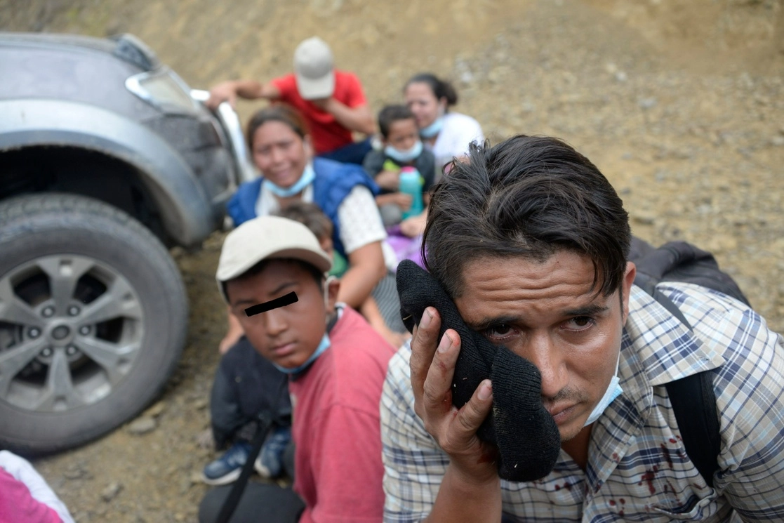 Integrantes de la caravana migrante resultó herido tras las acciones de dispersión por parte de autoridades de seguridad en Vado Hondo, Guatemala, el 18 de enero de 2021. Foto Afp