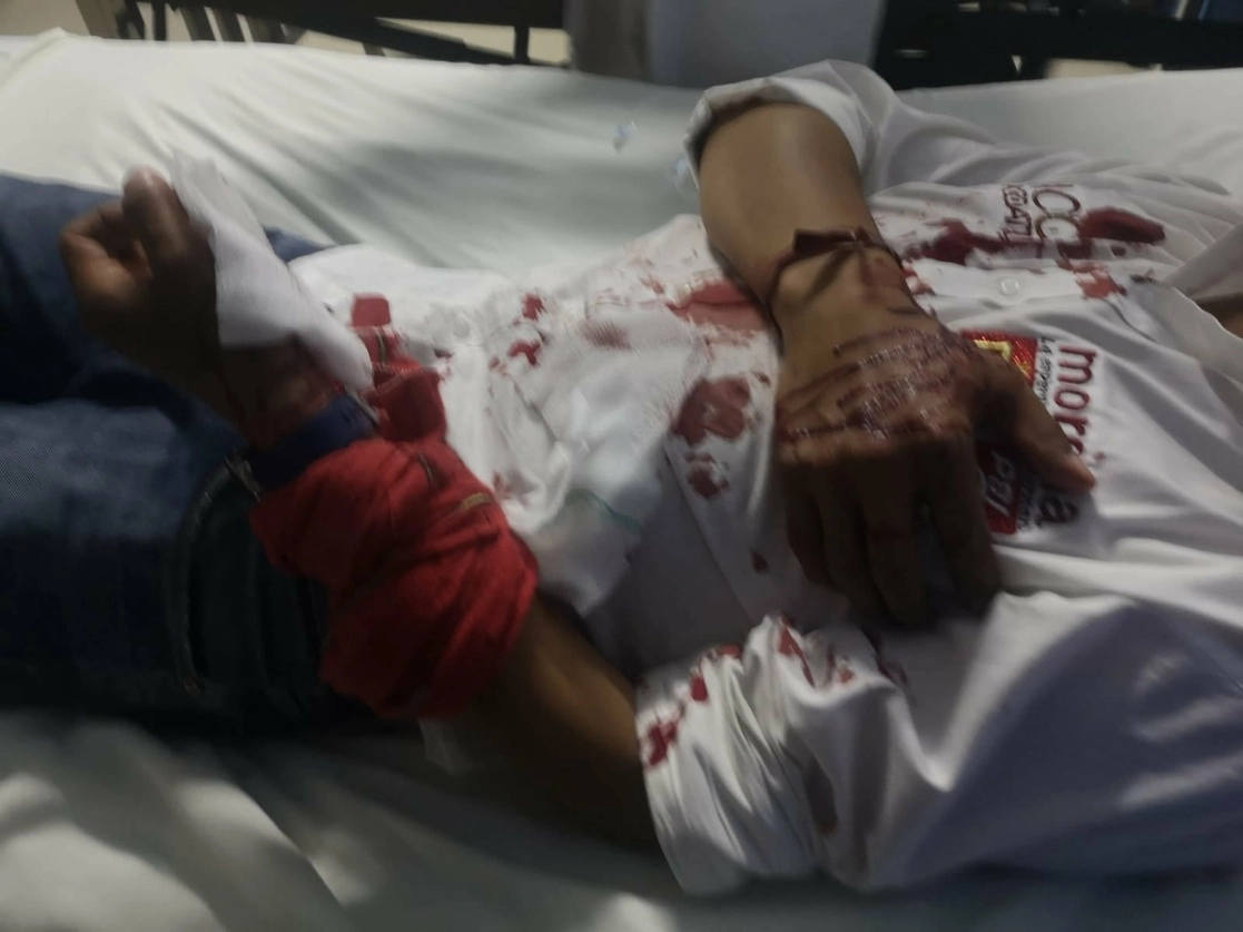 El candidato de Morena a la alcaldía de Santa Clara Ocoyucan, Puebla, Francisco Pancóatl fue atacado a balazos la noche del jueves cuando viajaba en su camioneta a la altura del puente de San Bernardino Chalchihuapan. Foto tomada de la cuenta de Facebook del aspirante