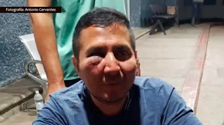 Cristian Ojeda señaló públicamente que “no es un medio muy querido por las administraciones y siento que por ahí se pudo dar el ataque”. Foto: Antonio Cervantes