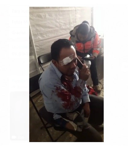 El agredido acudió a una estación policiaca a levantar la denuncia y ahí recibió atención médica para sus lesiones. Foto La Jornada