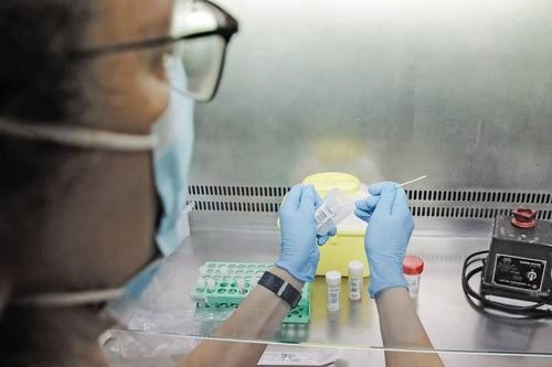 Detección de la viruela del mono en un hospital de Madrid, en imagen de archivo. Foto Europa Press