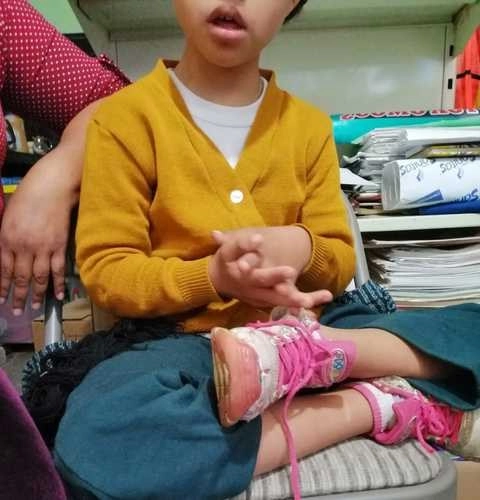 Xóchitl padece varias discapacidades y recibe educación especial en el Centro de Atención Múltiple número 86 ubicado en el cerro Lomas de San Isidro, en el municipio de La Paz, estado de México, donde es imposible utilizar silla de ruedas. Foto Diana Ramón /Archivo