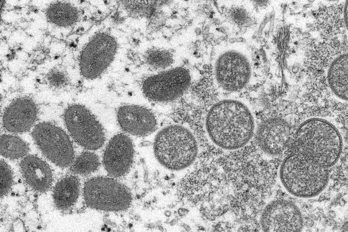 Viriones maduros de viruela del mono de forma ovalada, a la izquierda, y viriones inmaduros esféricos, a la derecha, obtenidos de una muestra de piel humana asociada con el brote de perrito de las praderas de 2003, en una imagen de microscopio electrónico de 2003, difundida por los Centros para el Control y Prevención de Enfermedades de Estados Unidos. Foto Ap / Archivo