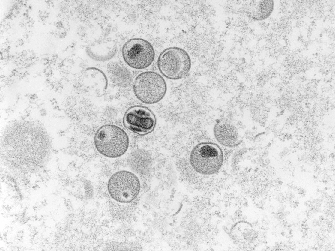 Partículas víricas de viruela símica vistas a través de un microscopio. Foto Afp / Archivo