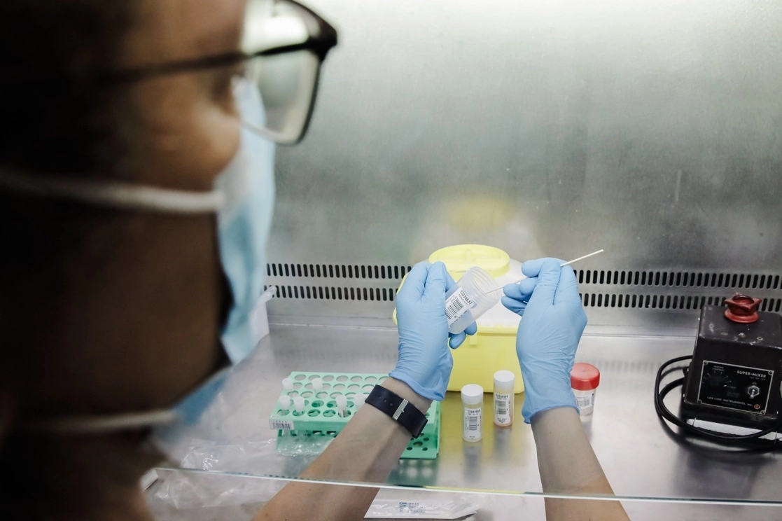 Una técnico de laboratorio sostiene una de las pruebas de análisis para la viruela del mono, en imagen de archivo. Foto Europa Press