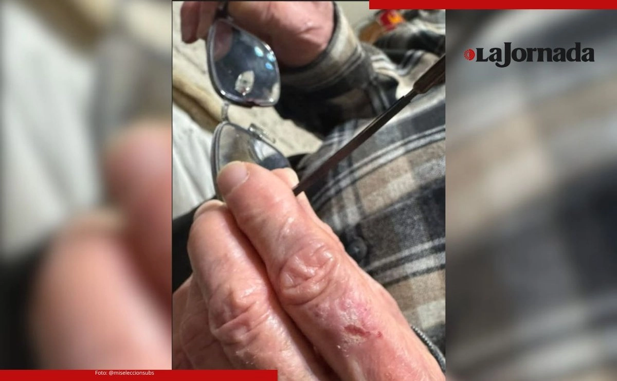 El propio prelado informó del incidente a través de sus redes sociales, donde detalló que los lentes que portaba se rompieron y una de las patillas se le incrustó en la nariz. Foto