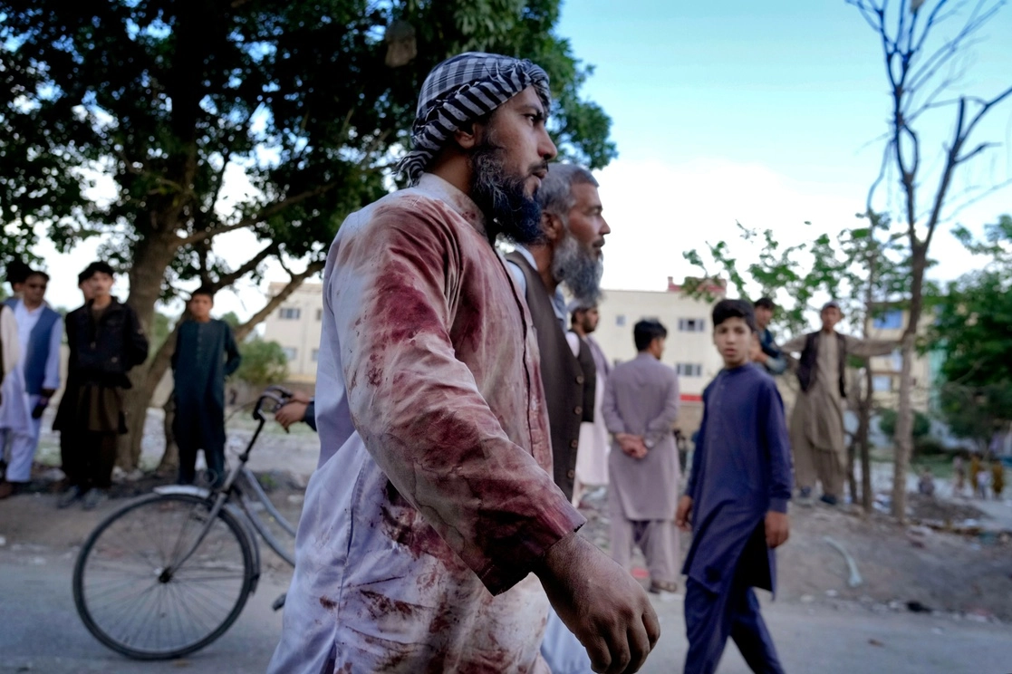 Un hombre manchado de sangre camina alrededor de la mezquita donde ocurrió la explosión, en Kabul, Afganistán, el viernes 29 de abril de 2022. Foto Ap