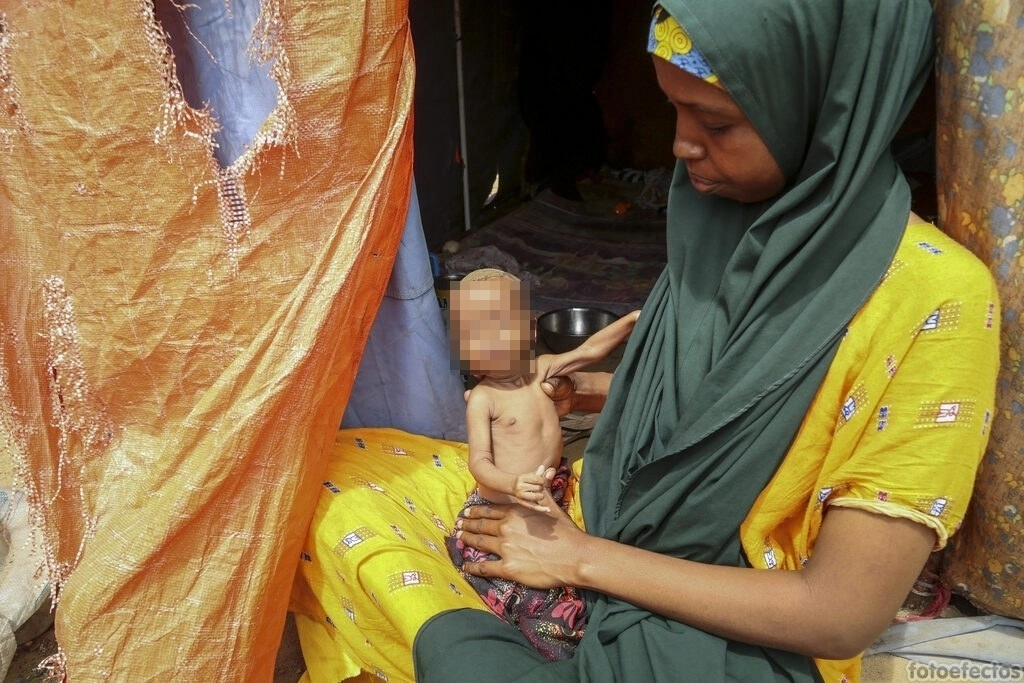 Amina Shuto, de 21 años, que huyó de la zona del Bajo Shabelle asolada por la sequía, sostiene a su hijo desnutrido de dos meses en un campamento improvisado para desplazados en las afueras de Mogadiscio, Somalia. Foto Ap