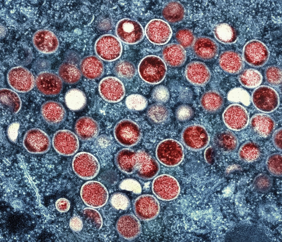 Micrografía electrónica de transmisión coloreada de partículas de viruela del mono (rojo) encontradas dentro de una célula infectada (azul) cultivadas en laboratorio en el Centro de Investigación Integrada (IRE, por sus siglas en inglés) del Instituto Nacional de Alergias y Enfermedades Infecciosas (NIAID, por sus siglas en inglés) , en Fort Detrick, Maryland. Foto NIAID vía Ap