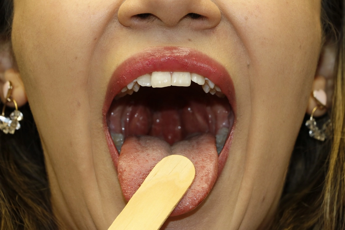 Amígdalas, paladar blando y la base de la lengua actúan como hospederos, brindando acceso a su capa basal para la reproducción viral, señaló el experto. Foto cortesía Cinvestav