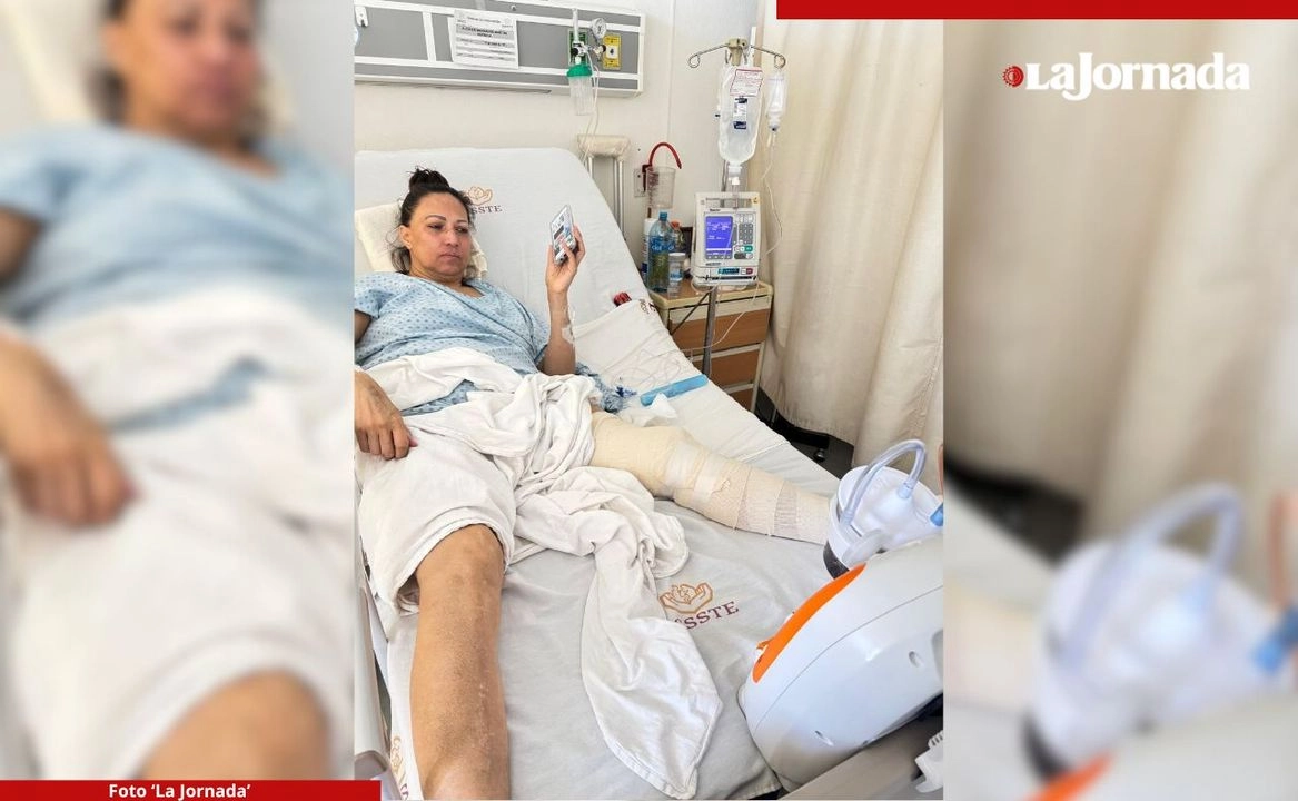 A Martha Patricia Alcocer Granados le han tenido que reconstruir la rodilla izquierda a causa de una infección adquirida tras una artroscopia que le fue realizada en el hospital del Issste de León, Guanajuato. Foto 