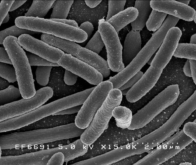 Bacteria de E. Coli aumentada 15 mil veces. Imagen Rocky Mountain Laboratories, NIAID, NIH, dominio público, a través de Wikimedia.org