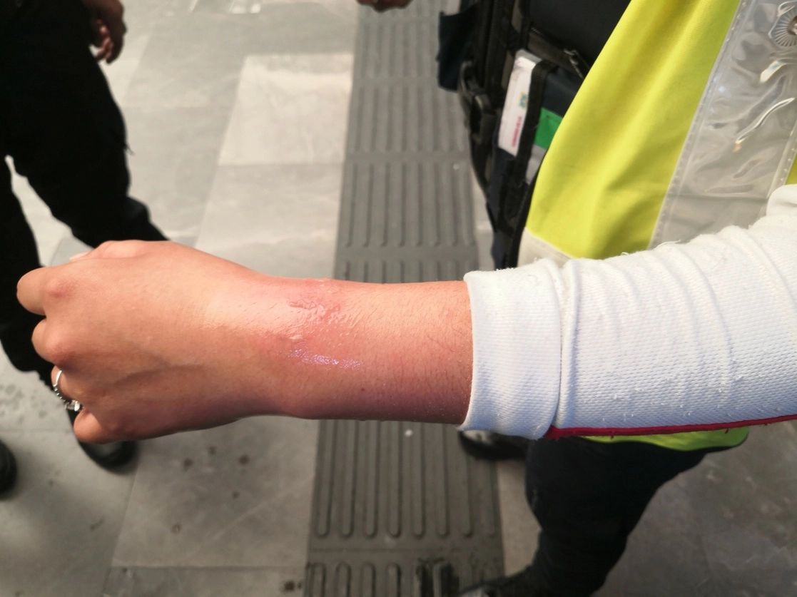 Una policía fue mordida por una usuaria en la estación Insurgentes del Metro. Foto Elba Mónica Bravo