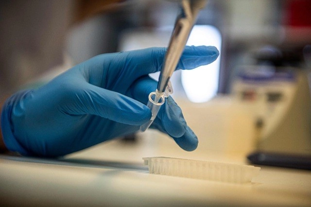La potencial vacuna de Moderna, denominada mRNA-1273, se encuentra en la fase tres de pruebas en humanos. La imagen, en el laboratorio de Neurobilogía de la Universidad Cayetano Heredia de Lima, Perú. Foto Afp 