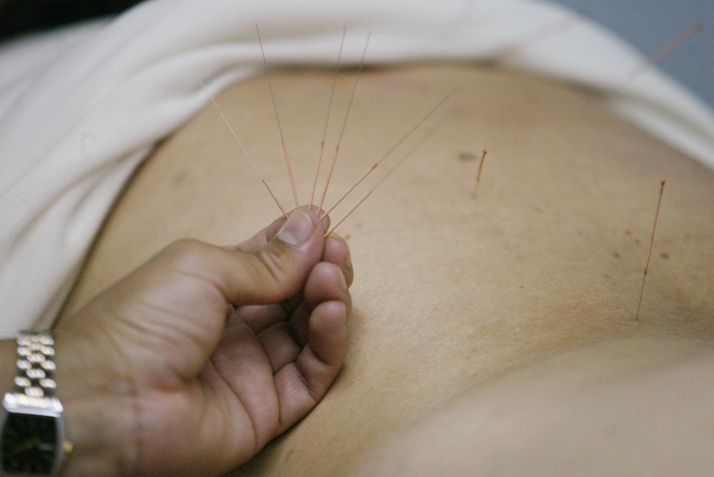 Experimentar los beneficios de esta técnica me llevó a estudiarla, expresó la doctora Becerril. Foto 



