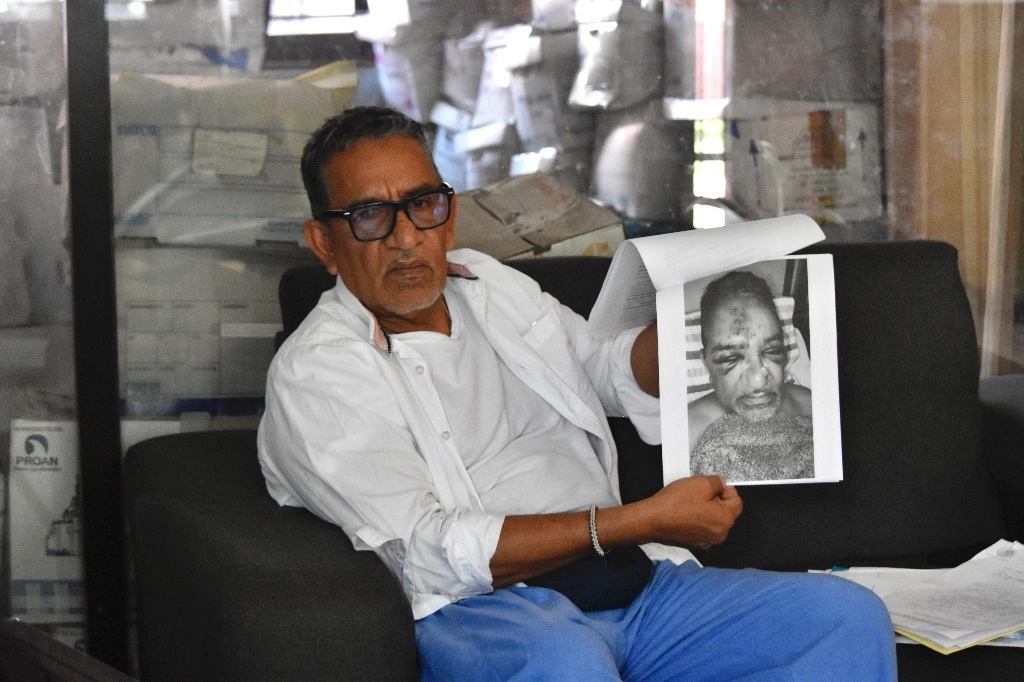 El activista Luis García Villagrán, del Centro de Dignificación Humana AC, expuso que padece secuelas por el atentado en su contra en octubre pasado. Foto Edhar H. Clemente
