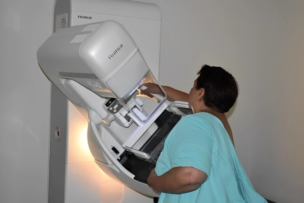 De acuerdo con la Sociedad Americana del Cáncer, se estima que una de cada ocho mujeres en el planeta podría desarrollar cáncer de mama en algún momento de su vida. Foto 