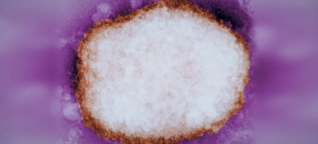 Partícula amplificada del virus de la viruela del mono. Imagen Europa Press