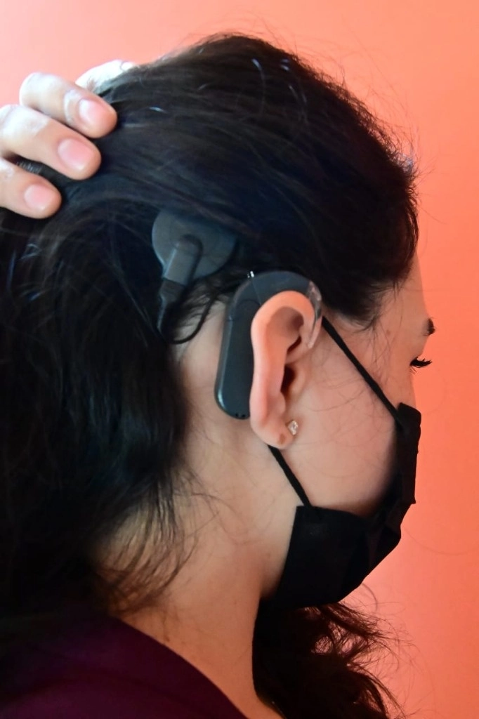 Paciente utiliza un procesador para implante coclear. Foto Secretaría de Salud 